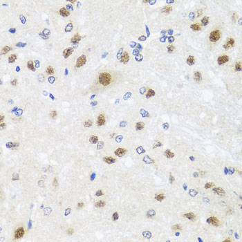 CETN3 Rabbit Polyclonal Antibody - Image 3