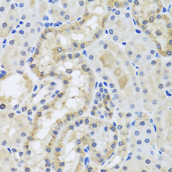 CETN3 Rabbit Polyclonal Antibody - Image 4