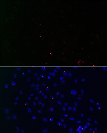 CETN3 Rabbit Polyclonal Antibody - Image 5