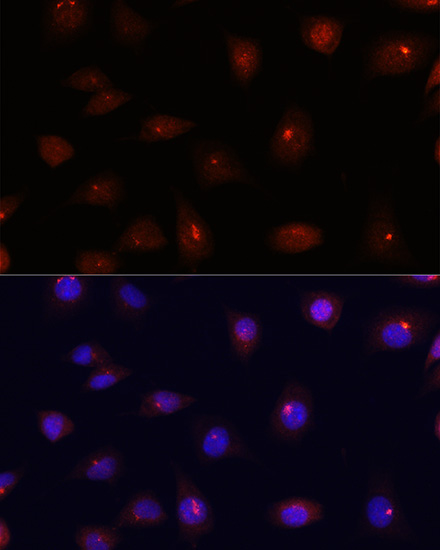 CETN3 Rabbit Polyclonal Antibody - Image 6