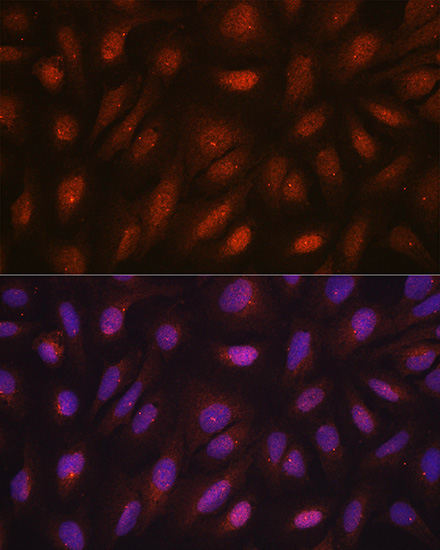 CETN3 Rabbit Polyclonal Antibody - Image 7