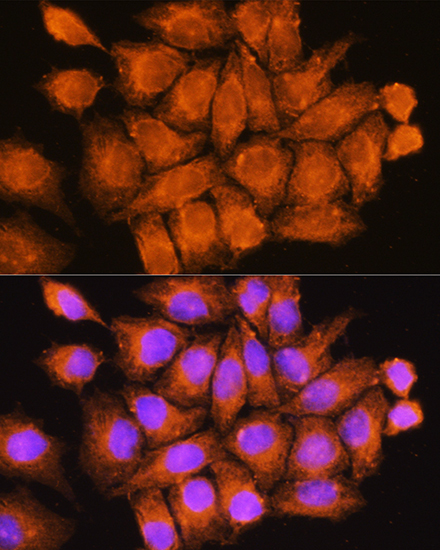CFAP53 Rabbit Polyclonal Antibody - Image 2