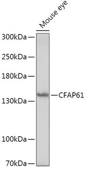 CFAP61 Rabbit Polyclonal Antibody