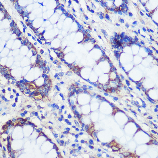 CFAP61 Rabbit Polyclonal Antibody - Image 2