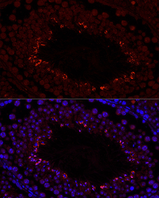 CFAP61 Rabbit Polyclonal Antibody - Image 3