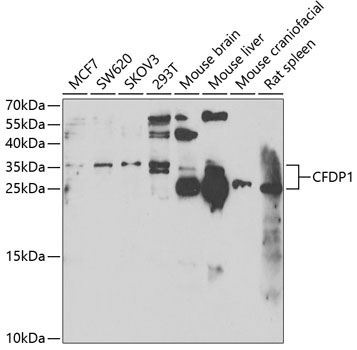 CFDP1 Rabbit Polyclonal Antibody