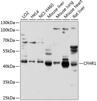 CFHR1 Rabbit Polyclonal Antibody