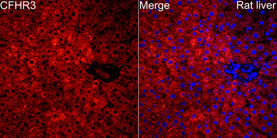 CFHR3 Rabbit Polyclonal Antibody - Image 3