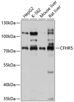 CFHR5 Rabbit Polyclonal Antibody