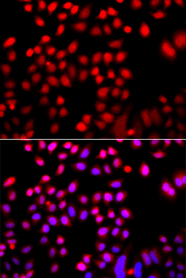 CFL2 Rabbit Polyclonal Antibody - Image 2