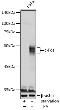 c-Fos Rabbit Polyclonal Antibody