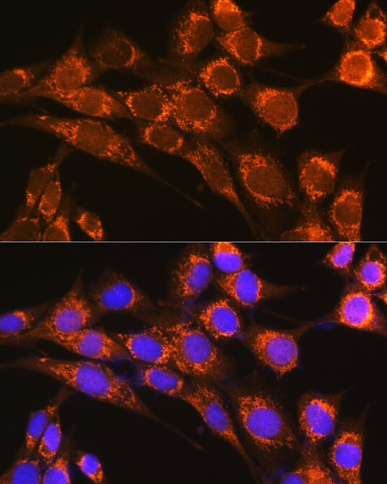 CFP Rabbit Polyclonal Antibody - Image 3
