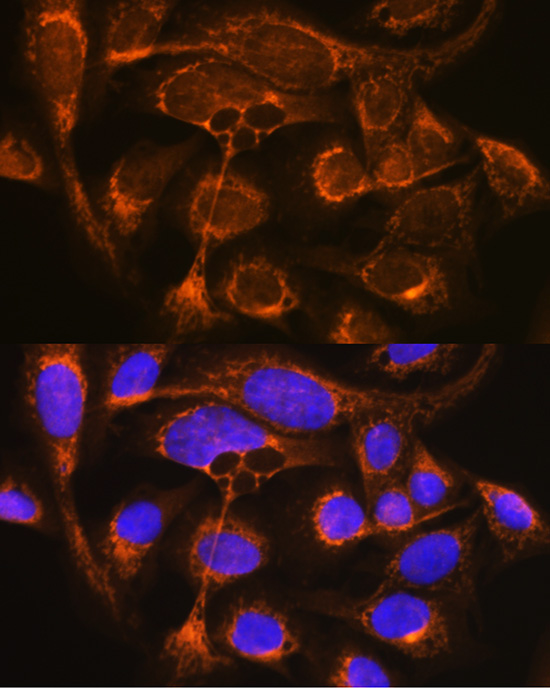 CFP Rabbit Polyclonal Antibody - Image 4