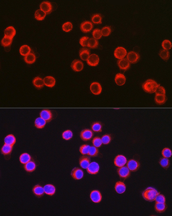 CFTR Rabbit Polyclonal Antibody - Image 2