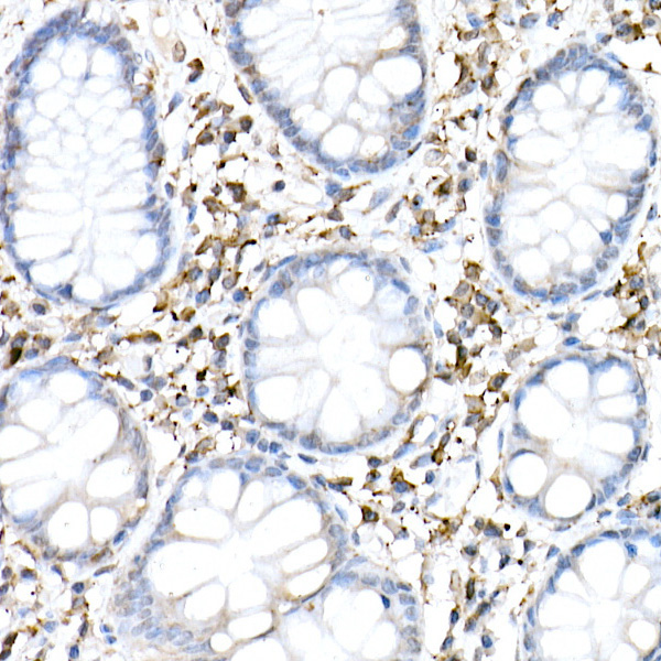 cGAS Rabbit Polyclonal Antibody - Image 5