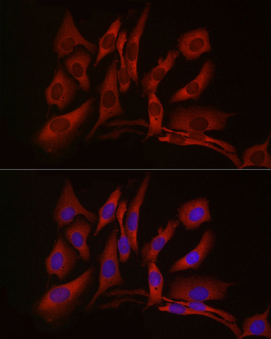 cGAS Rabbit Polyclonal Antibody - Image 6