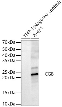 CGB Rabbit Polyclonal Antibody