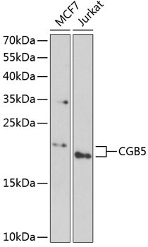 CGB5 Rabbit Polyclonal Antibody