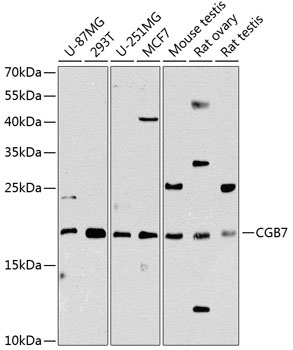 CGB7 Rabbit Polyclonal Antibody