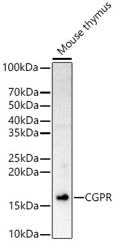 CGPR Rabbit  Polyclonal Antibody