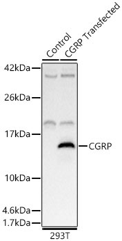 CGRP Rabbit Polyclonal Antibody