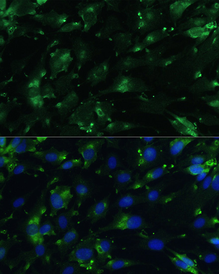 CGRP Rabbit Polyclonal Antibody - Image 2