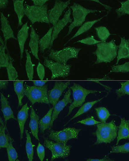 CGRP Rabbit Polyclonal Antibody - Image 3