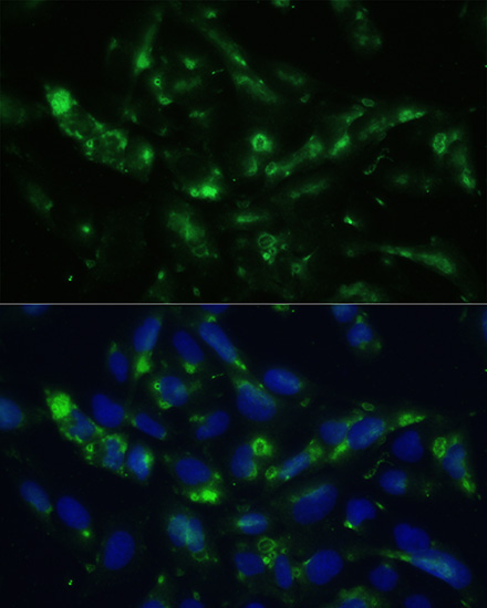 CGRP Rabbit Polyclonal Antibody - Image 4