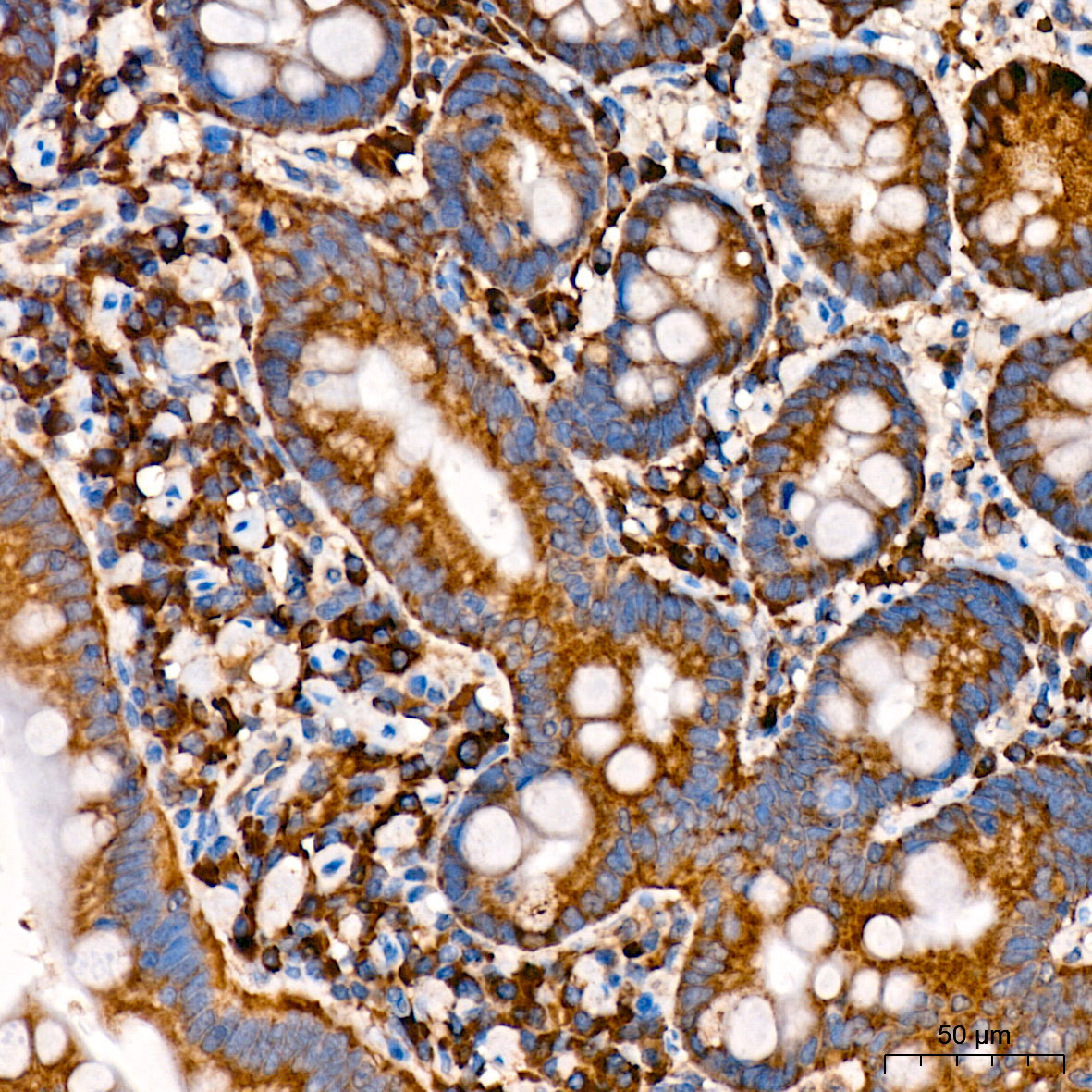 CHAC1 Rabbit Polyclonal Antibody - Image 2