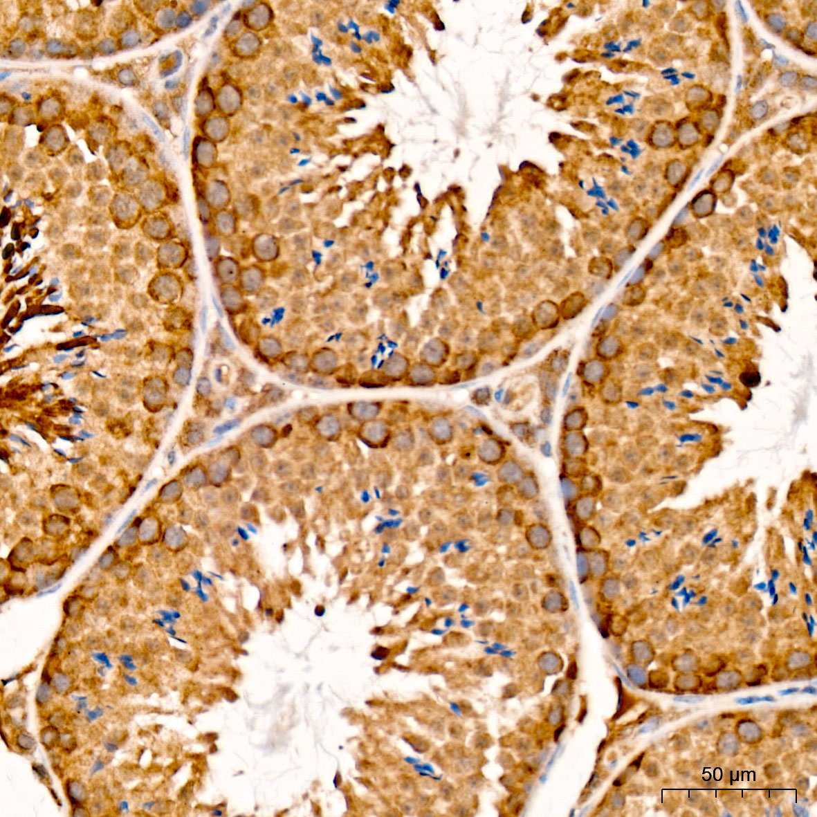 CHAC1 Rabbit Polyclonal Antibody - Image 3