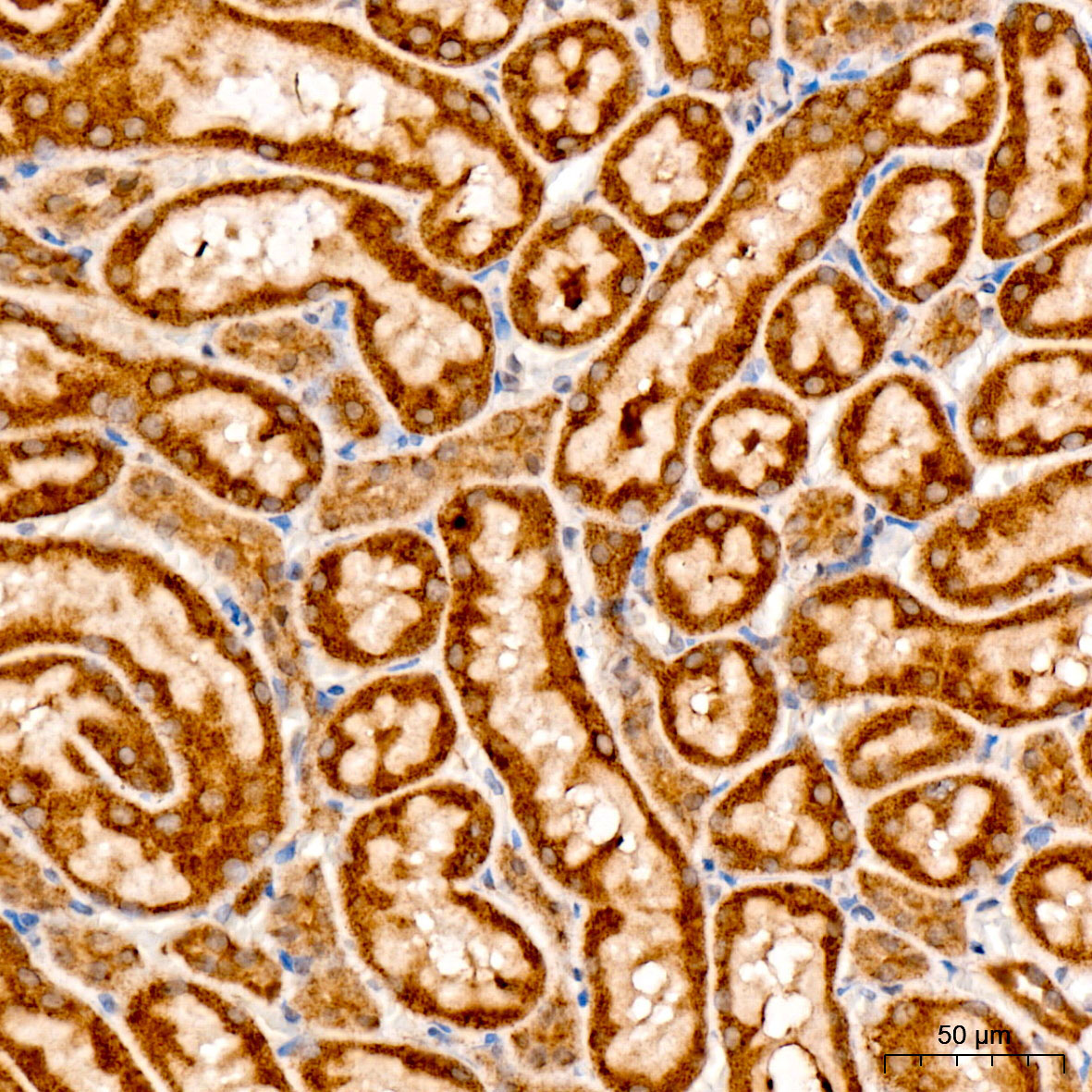 CHAC1 Rabbit Polyclonal Antibody - Image 4