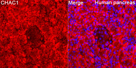 CHAC1 Rabbit Polyclonal Antibody - Image 5