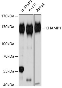 CHAMP1 Rabbit Polyclonal Antibody