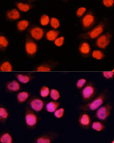 CHAMP1 Rabbit Polyclonal Antibody - Image 2