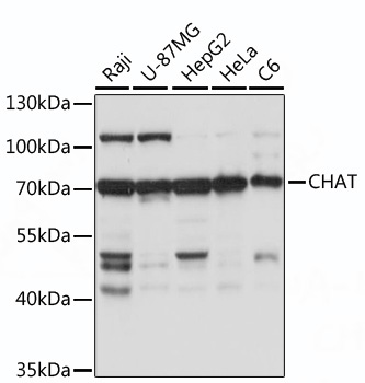CHAT Rabbit Polyclonal Antibody