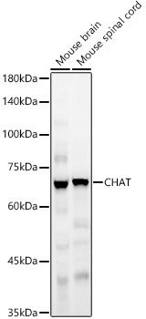 CHAT Rabbit Polyclonal Antibody - Image 2