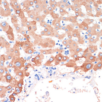 CHAT Rabbit Polyclonal Antibody - Image 3