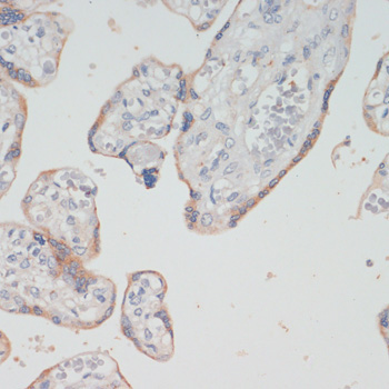 CHAT Rabbit Polyclonal Antibody - Image 4