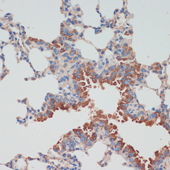 CHAT Rabbit Polyclonal Antibody - Image 5
