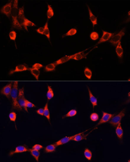 CHAT Rabbit Polyclonal Antibody - Image 6