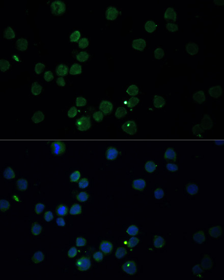 CHAT Rabbit Polyclonal Antibody - Image 7