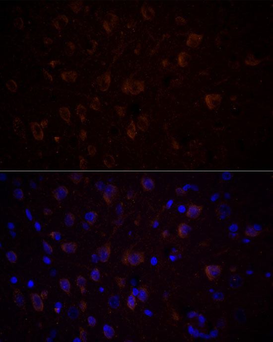 CHAT Rabbit Polyclonal Antibody - Image 8