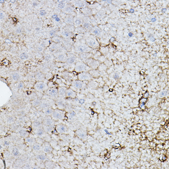 CHAT Rabbit Polyclonal Antibody - Image 2
