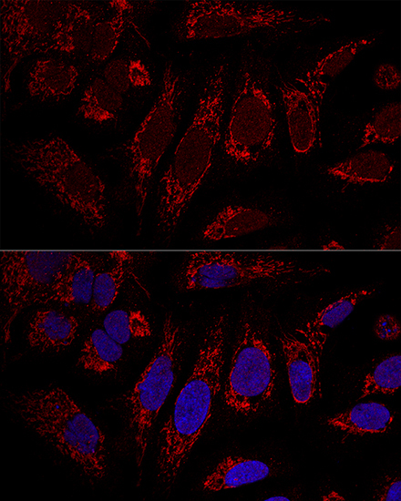 CHCHD3 Rabbit Polyclonal Antibody - Image 2