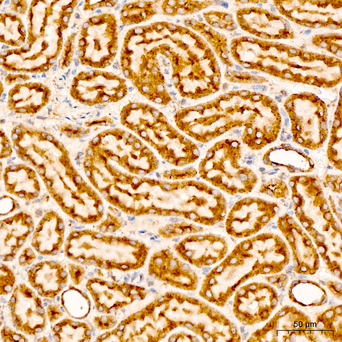 CHCHD4 Rabbit Polyclonal Antibody - Image 2