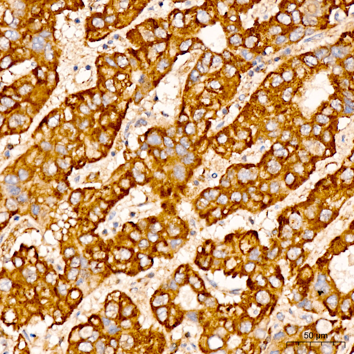 CHCHD4 Rabbit Polyclonal Antibody - Image 3