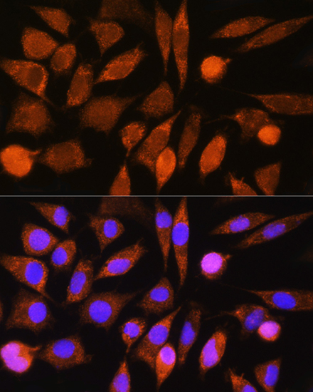 CHCHD7 Rabbit Polyclonal Antibody - Image 2