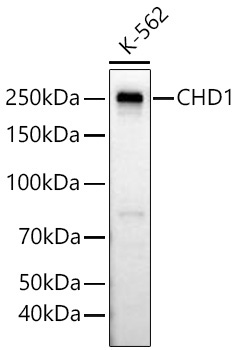 CHD1 Rabbit Monoclonal Antibody