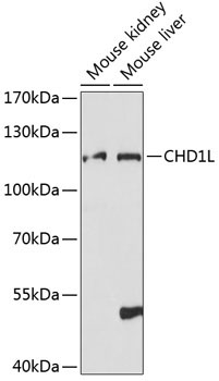CHD1L Rabbit Polyclonal Antibody