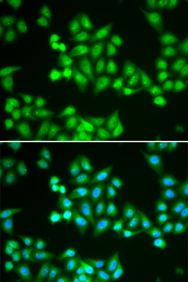CHD2 Rabbit Polyclonal Antibody